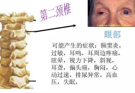 颈椎段脊柱受损或受累，有些部位或器官就有可能发生疾患